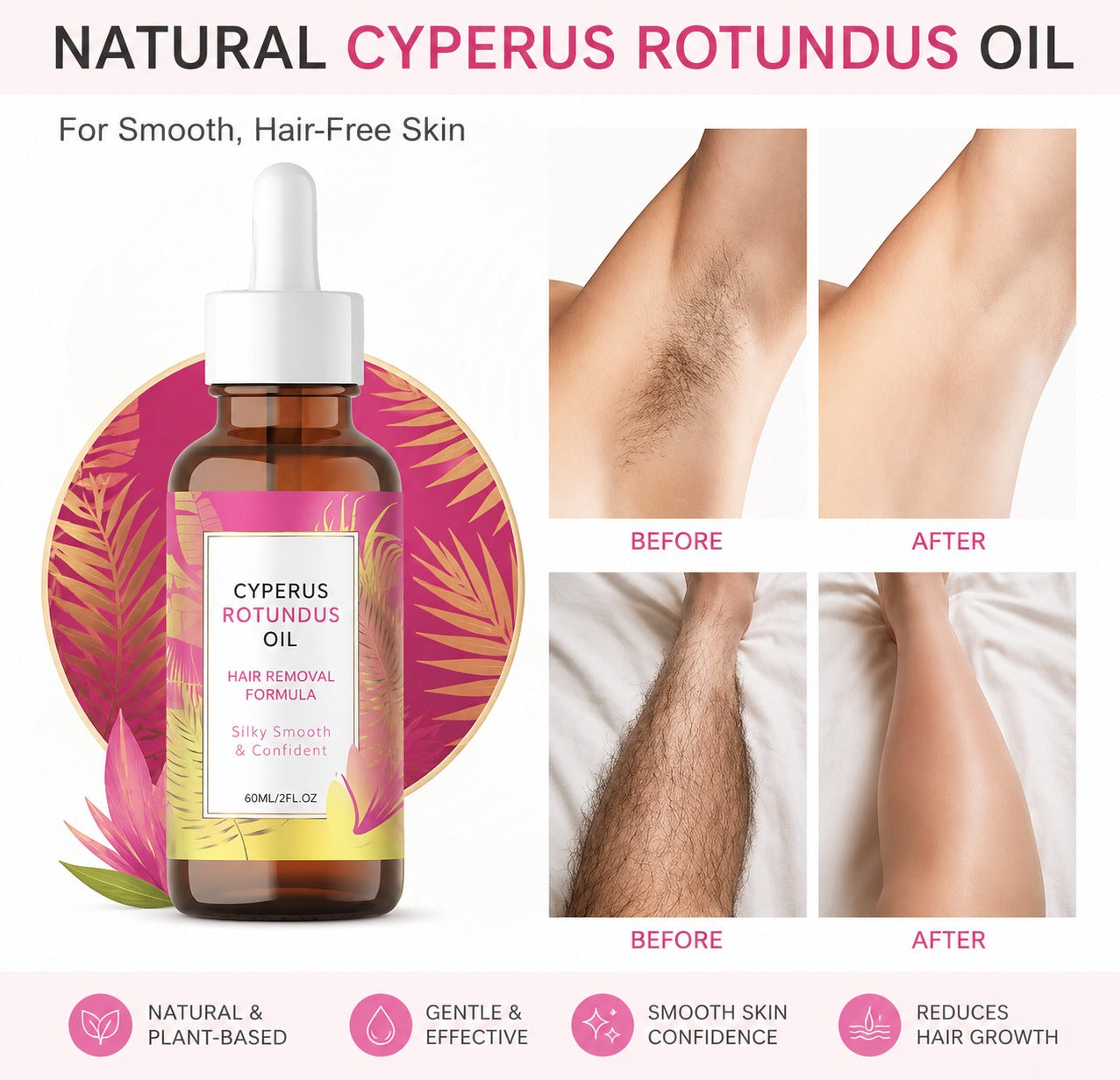 CYPERUS ROTUNDUS PARA RETARDAR EL CRECIMIENTO DEL VELLO